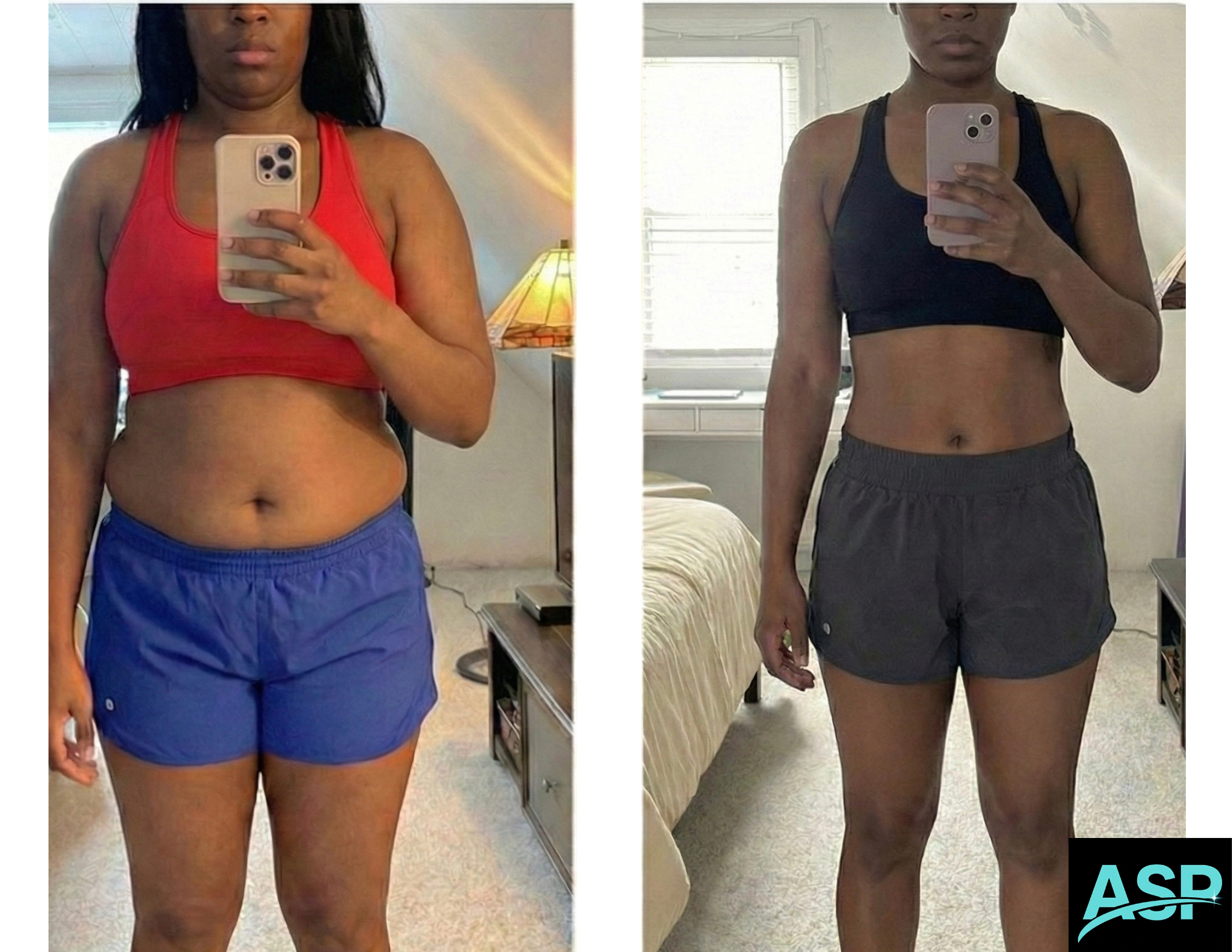 Female client body transformation